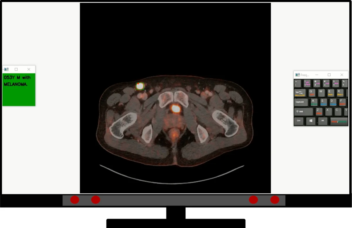 Data collection platform. The PET/CT study was shown to readers in a full-screen application alongside some information about the patient and a keybindings legend.