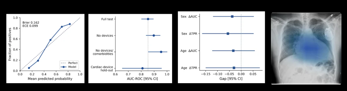 Deployment-oriented evaluation using the expert-curated cohort. (A) Reliability diagram showing predicted versus observed probabilities (Brier score = 0.162, ECE = 0.099). (B) Robustness analysis across clinically relevant evaluation cohorts. (C) Fairness analysis reporting differences in discrimination (AUC) and sensitivity (TPR) across age and sex; error bars denote 95\% confidence intervals. (D) Representative Grad-CAM visualization suggesting that model attention concentrates on the cardiac silhouette rather than implanted cardiac devices.