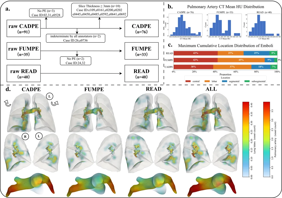 Characteristics of the three re-annotated PE datasets. (a) Case-selection flowchart yielding 149 cases (CADPE, n = 76; FUMPE, n = 33; READ, n = 40); excluded case IDs shown. (b) Mean CT attenuation of the central pulmonary arteries per dataset (HU). (c) Per-case distribution of the anatomic location with the maximum cumulative embolus burden. (d) Voxel-wise embolus density after registration to a common lung template, per dataset and pooled (ALL): anterior view of the lung volume (top row), medial (mediastinal) surface view (middle row), and the pulmonary-arterial surface (bottom row); color bars encode local voxel count. R/L = right/left lung.