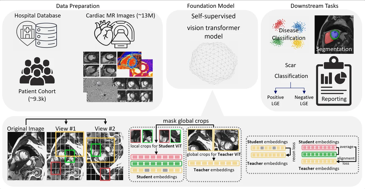 Overview of the ORION-CMR (pretrained on 9,258 CMR studies) framework for scanner-native end-to-end CMR analysis and automated report generation.