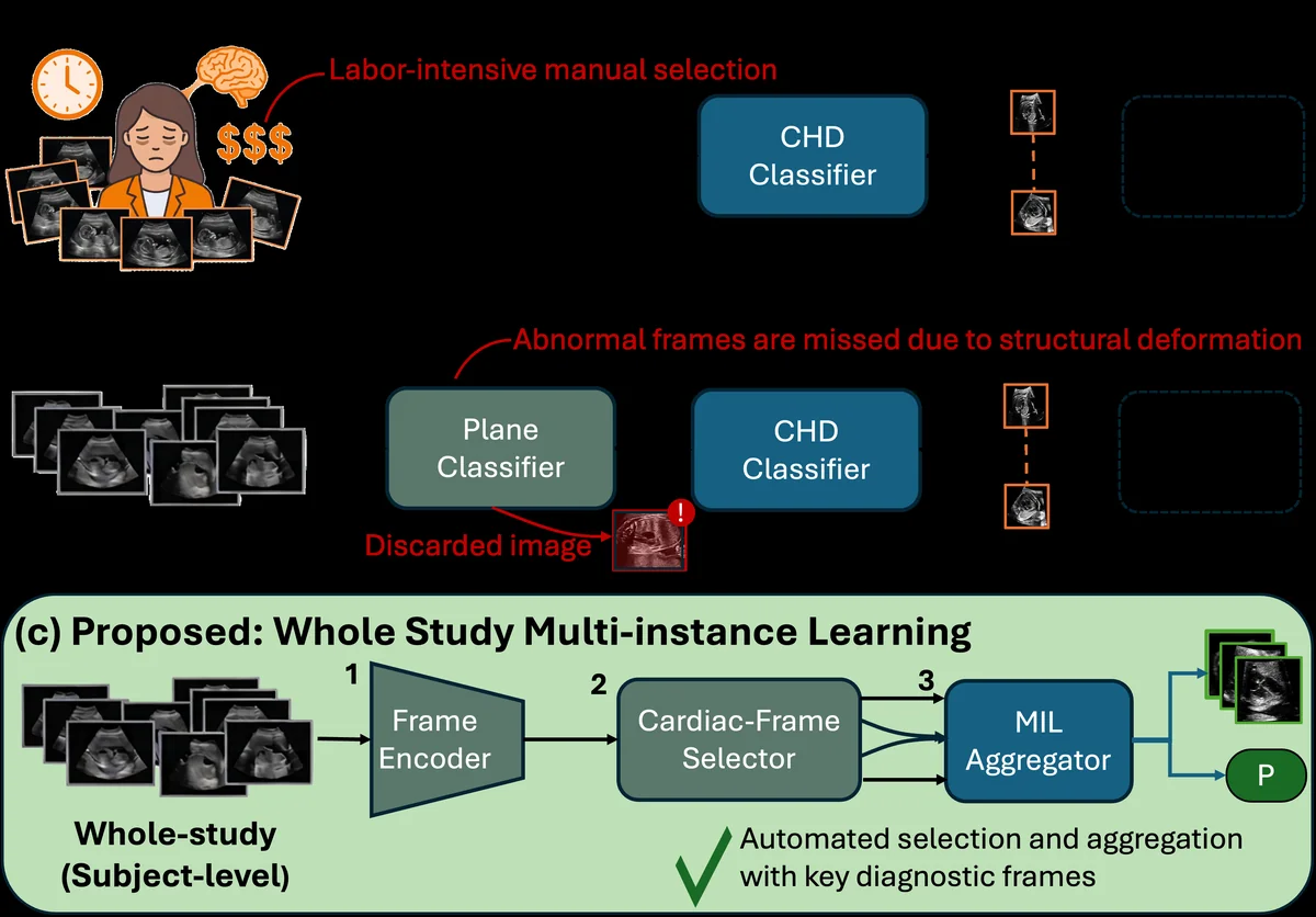 Three designs for AI-based prenatal CHD screening. (a) Expert-selected images: a clinician manually selects representative frames, each is scored by a CHD classifier, and the per-image predictions must still be combined into a diagnosis. (b) Two-stage design: a plane classifier first identifies standard cardiac views before diagnosis. Because these classifiers are designed to recognize standard cardiac structures and are predominantly trained on normal anatomy, they may discard abnormal cardiac frames. Aggregation is again required as the design produces per-image predictions. (c) Proposed whole-study design: the entire study enters at subject level. The frame encoder embeds every frame, a disease-robust cardiac-frame identifier gates which frames enter the bag, and a MIL aggregator produces one subject-level prediction while surfacing the key diagnostic frames that support it.