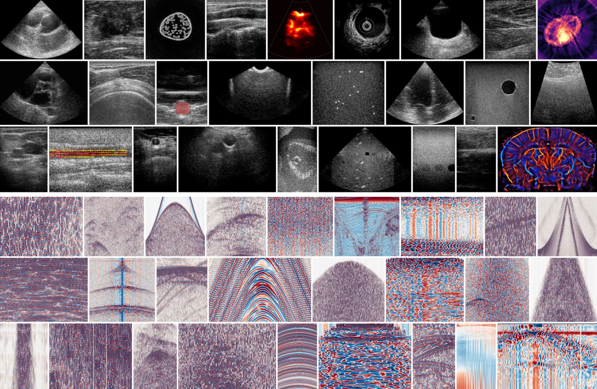 Impression of the dataset. Top: reconstructed images from a selection of samples across the contributions. Bottom: the corresponding (demodulated) raw channel data from the same samples, in matching order.